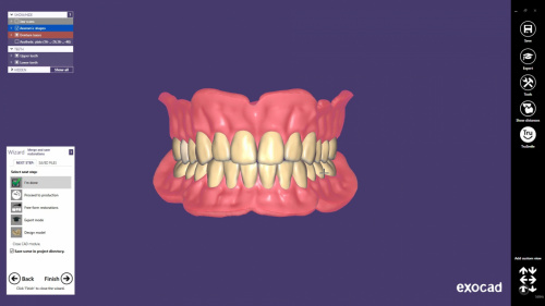 Модуль Exocad Full Denture Module. Модуль полносъемных протезов