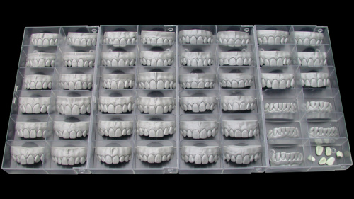 Модуль Exocad Tooth Library. Дополнительная библиотека естественных зубов