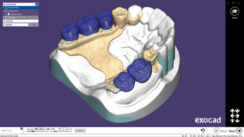 Модуль Exocad Partial Framework Module. Модуль создания бюгелей
