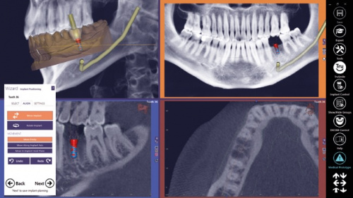 Модуль Exocad DICOM viewer. Средство просмотра DICOM файлов