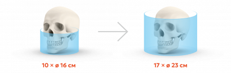 UPGRADE. Модернизация аппаратов DEXIS